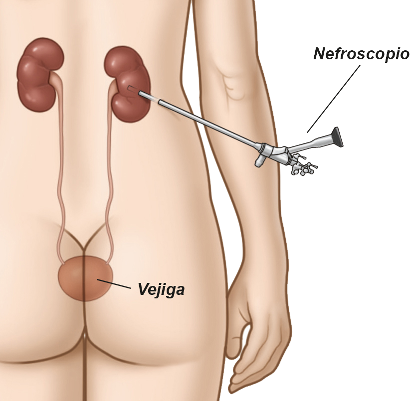 Enfermedades de transmisión sexual